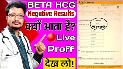 beta hcg labchecap,beta hcg negativo